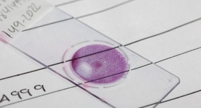 Liquid based cytology microscope slide for pap smear test