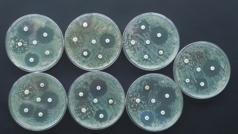Antimicrobial susceptibility test Antibiogram Antibiotic resistance bacteria